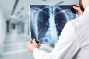 cheapest X-ray in Panchkula