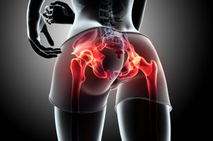 best hip replacement surgeon in Chandigarh